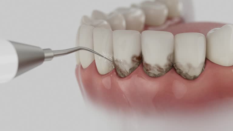 Reliable Dental Implants contractor in Sultana, CA by Smile Center Dentistry
